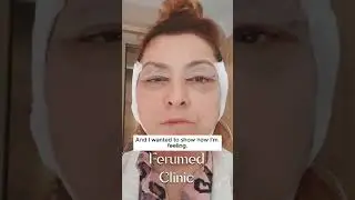 Gesicht Straffen #ferumedclinic #aesthetic #plasticsurgery #istanbul