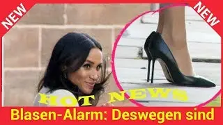 Blasen-Alarm: Deswegen sind Meghans Schuhe immer zu gro&szlig;