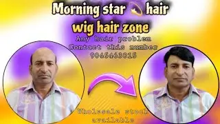 mob 9045463015 hair wig patch wholesale supplier training fixing centre in agra mathura bharatpur