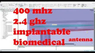 403mhz and 2.4ghz biomedical implantable antenna for endoscopy in hfss