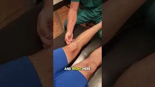 Foot Nerve Causing Sciatica?! Watch This 👀