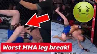 WORST MMA LEG INJURY EVER! 🤮🤢