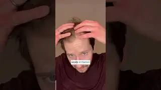 MDhair