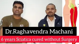 Sciatica cured without Surgery: Dr.Raghavendra | Sciatica Specialist | Dry Needling specialist |