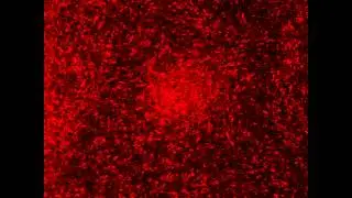 E.coli Collective Motion