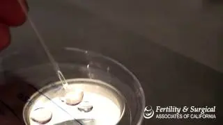 Embryo and Oocyte Thawing Protocol | Fertility and Surgical Associates of California