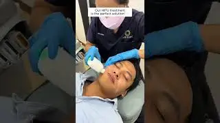 Scared to go under the knife but want a V-shaped look? We got you! Try HIFU Treatment!