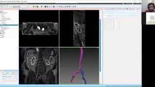SimVascular Tutorial 5: Model Building
