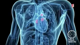 Santé - Réparer le cœur sans ouvrir