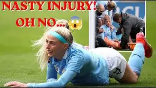 🦵🦵Chloe Kelly nasty knee injury 🩹 Manchester City Women #football #trending #viral #viralvideo