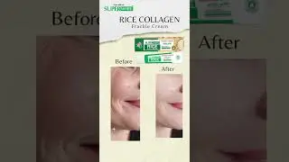 Superwhite Freckle Cream