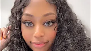BBL Vlog2024|WARNING ⚠️DoNotBook with VIXEN PLASTIC SURGERY-part1|candicream