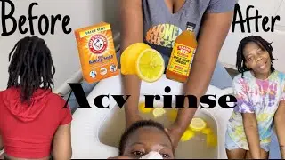 HOW I DETOX STEEVENA&rsquo;s LOCS (ACV RINSE) #locstyles #detox #hair #keepingupwiths&s