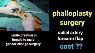 Phallplasty surgery for transgenders in India Delhi Mumbai pune Hyderabad Bangalore ahmedabad