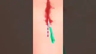 #3danimationsurgery #gameplay #animation #doctor #3danimation #games #funny #comedy #hospital