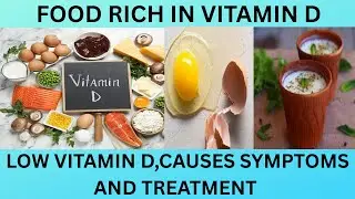 ALIMENTS RICHES EN VITAMINE D. SOURCES DE VITAMINE D. BESOINS EN VITAMINE D, CARENCE ET SYMPT&Ocirc;MES
