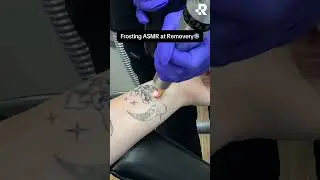 ASMR Tattoo Removal ❄️ #asmr #removery