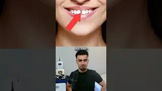 У вас редкое телосложение? 🤔