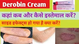 Derobin Ointment Use dose benifits and Sideeffects in Hindi l Derobin Cream 🥼⚕️