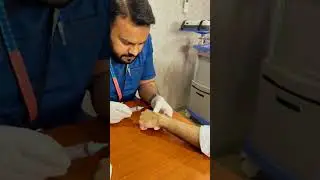 Ganglion Cyst | Aspiration Method | Dr Rizwan Basra