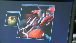 Surgical Rehearsal Platform Uses in Microsurgery