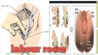 delivery room ki secret baten ||normal delivery ||personal exp||