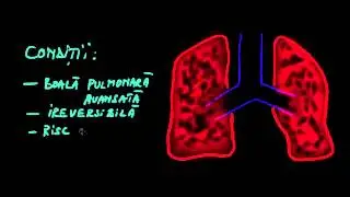 Cine poate primi un transplant pulmonar?