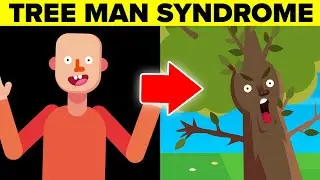 A Terrifying Disease That Will Turn You Into a Tree