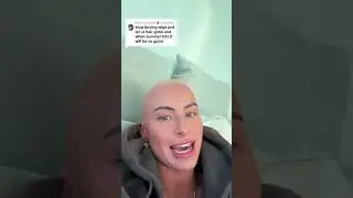 Smart thinking #bald #alopecia #hairloss