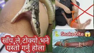 सर्प ले टोक्यो भने यस्तो गर्नु होला snake bite in nepal || nepali snake catcher