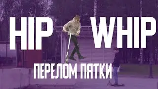 СЛОМАЛ ПЯТКУ! TWIX И HIP WHIP!