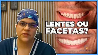 O segredo por trás das lentes e facetas dentais que ninguém te conta| Master Pride Odontologia |