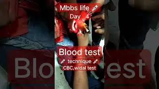 mbbs life 💉 blood test technique 💉 day_4 💉 CBC,widal test 💉#medical #mbbs #aiims #motivation #shorts