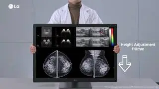 LG IT Medical Feature Overview Diagnostic Monitor 31HN713D