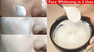 In 3 Uses👆🏼This Face Pack Whitens Skin Tone,  Removes Pigmentation, Tan & DuIl Skin- Gives Fair Skin