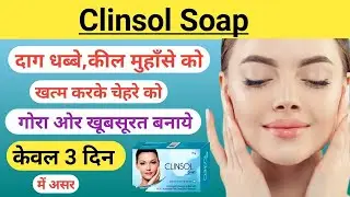 Clinsol Anti-Acne Soap | Uses, Benefits, Price & Side Effects in Hindi. 