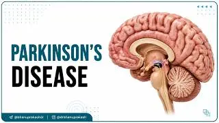 Parkinson's Disease (Hindi) : Internal Medicine