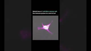 Cancer cell dying  #molecularhydrogen #hydrogenwater