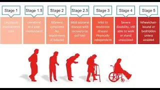 HOEHN AND YAHR SCALE-MADE EASY