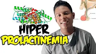 HIPERPROLACTINEMIA: causas, sus s&iacute;ntomas y el tratamiento  | Dr. Vargas