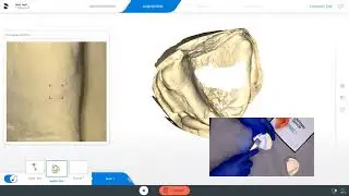 Model Scan with Primescan