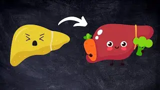 6 Vitamins to reverse a fatty liver (& Supplements)