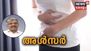 Dr.Q : അള്‍സര്‍ | Ulcer | 17th February 2020