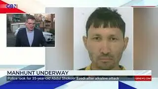 UK - Muslim immigrant acid attack