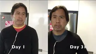 30 Day Potato Diet Before & After