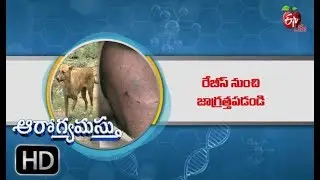 World Rabies Day  | Aarogyamastu | 26th September 2019 | ETV Life