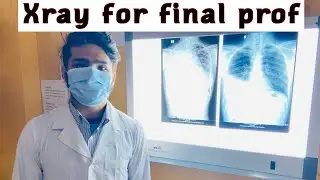 Xray|Final prof|Medicine|| Correction- Consolidation *****