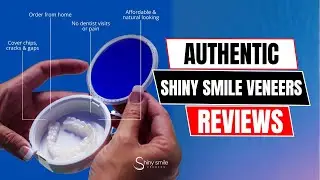 Shiny Smile Veneers Review &ndash; Final Verdict After Wearing Them!