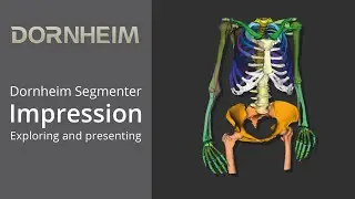 Dornheim Segmenter Impression - Exploring and presenting