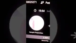 Malaria diagnosis using MiLab (noul)analyser